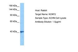 KCNT2 Rabbit anti-Human, Polyclonal, Novus Biologicals 0.1ml; Unconjugated:Antibodies,